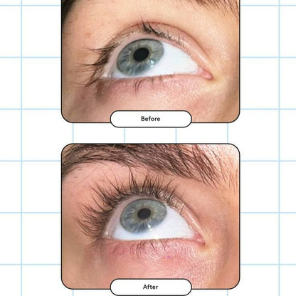 XLASH - Eyelash Serum (Available in 3ml or 5ml)