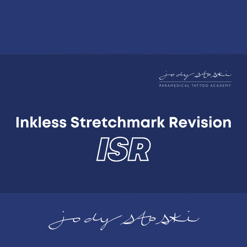 Jody Stoski Course - Inkless Stretch Marks Revision